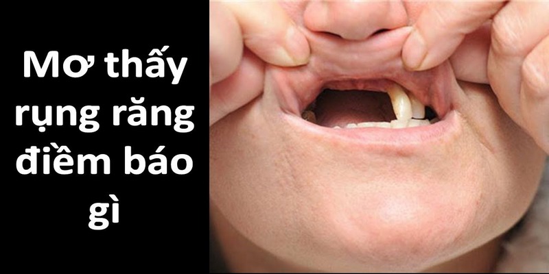 Mơ thấy răng rụng nhưng không kèm theo máu